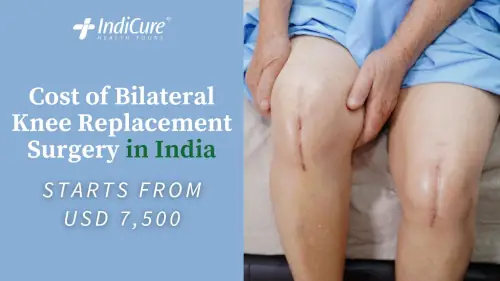 Cost of Bilateral Knee Replacement Surgery in India